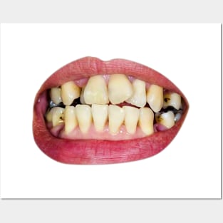 damaged teeth Posters and Art